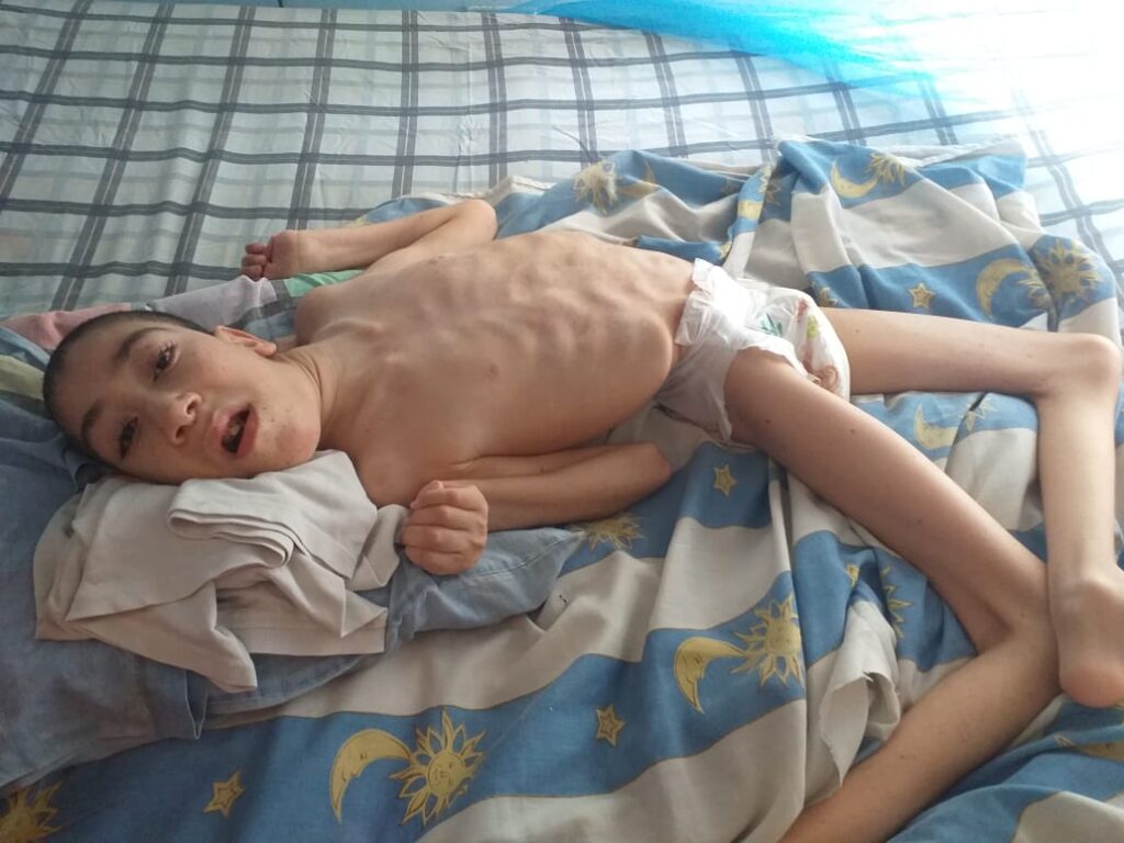 Madre de niño parapléjico por meningitis solicita ayuda para costear gastos de enfermedad