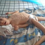 Madre de niño parapléjico por meningitis solicita ayuda para costear gastos de  enfermedad